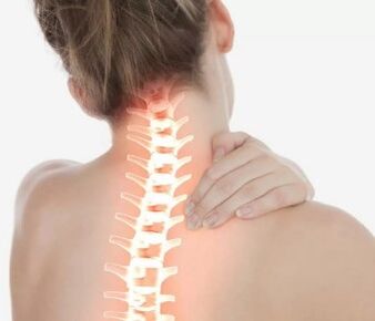 Osteocondrose cervical