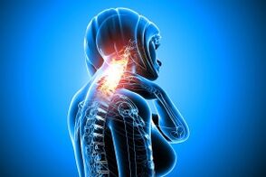 Osteocondrose na columna cervical